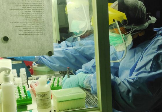 Laboratorium Deteksi Covid akan Dibangun
