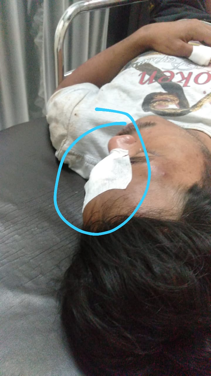 Lerai Pertengkaran Lima Bersaudara, Dikeroyok