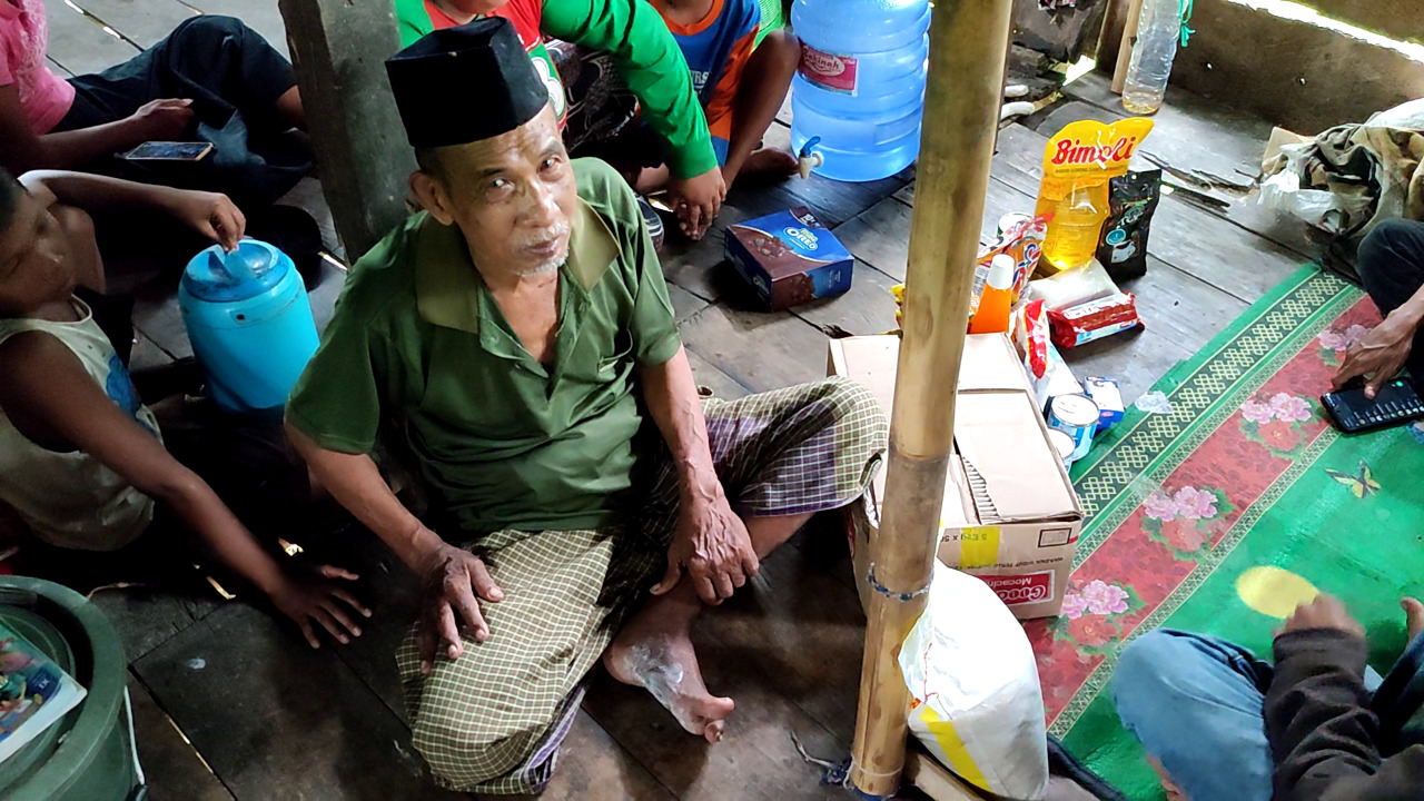 Mangati, Tumpuan Keluarga Kini Terbaring di Rumahnya yang Nyaris Rubuh