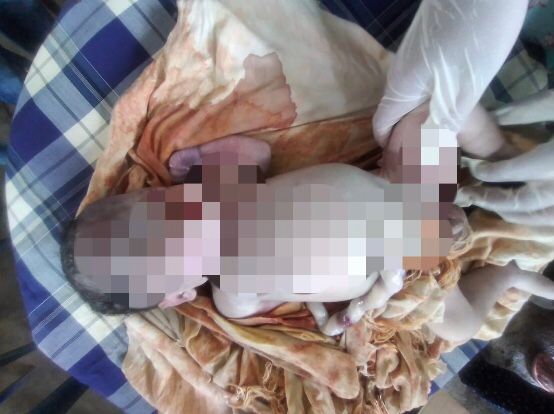 Bayi Ditemukan Meninggal Nyangkut di Sungai
