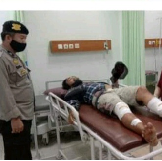 Ditebas Teman, Jari Jukir Putus