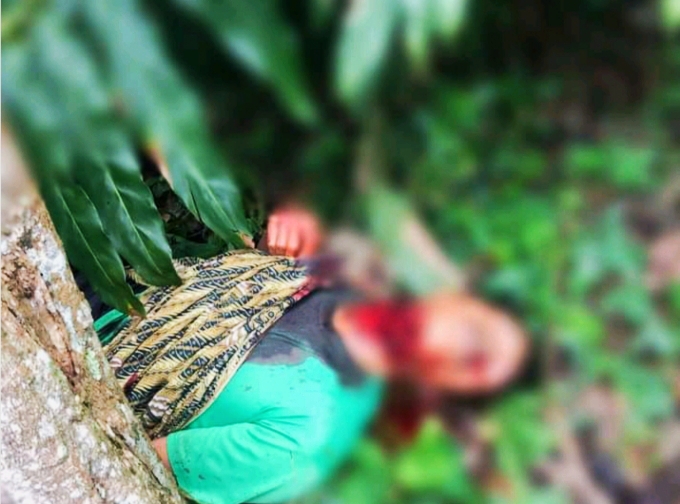 Diduga Depresi,  Suami Gorok Leher Sendiri Hingga Tewas