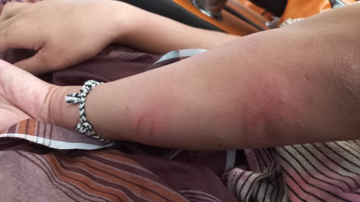Dugaan Penganiayaan Santri Berujung ke Polisi