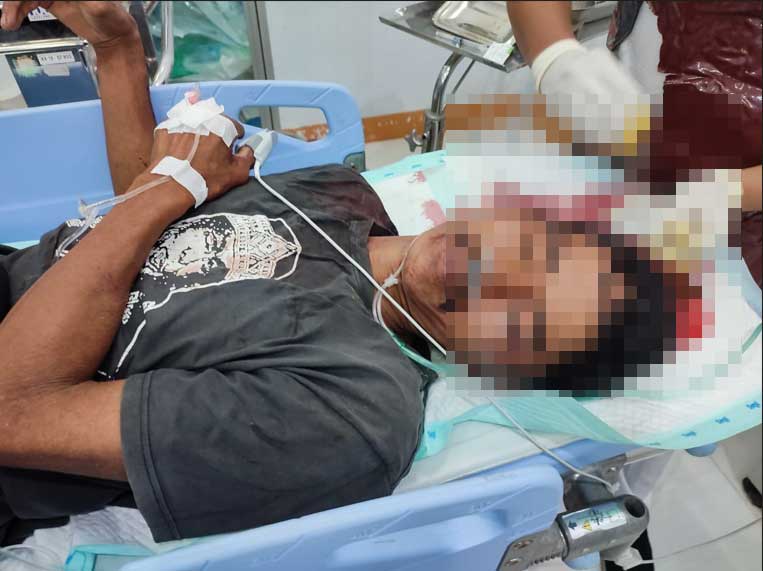 Gempar Warga Rano Dibacok Bersimbah Darah