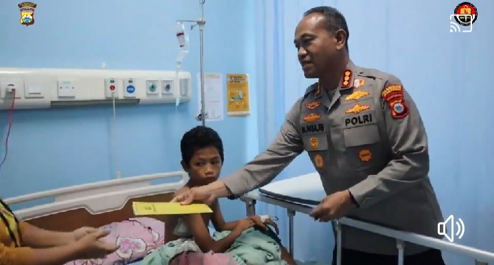 Kapolrestabes Besuk Bocah Terkena Peluru Senapan Angin
