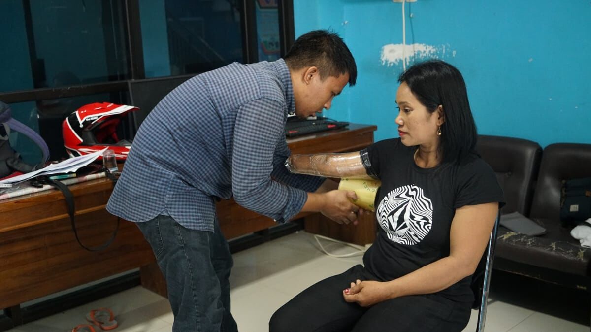 DAMPINGI -- Dinas Sosial Kabupaten Sidrap memfasilitasi dan mendampingi enam penyandang disabilitas menjalani pengukuran untuk pembuatan kaki palsu dan tangan palsu, Jumat (8/11). 
