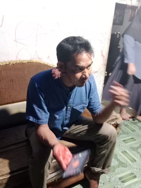 BUSUR -- Korban S (43) dengan anak panah busur yang tertancap di pipi sebelah kanannya 
