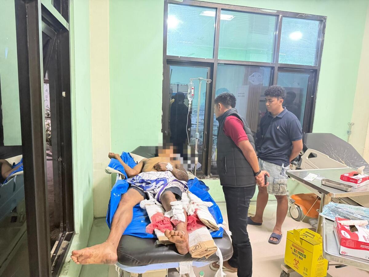 Residivis Curanmor di Bulukumba Ditangkap Usai Alami Kecelakaan