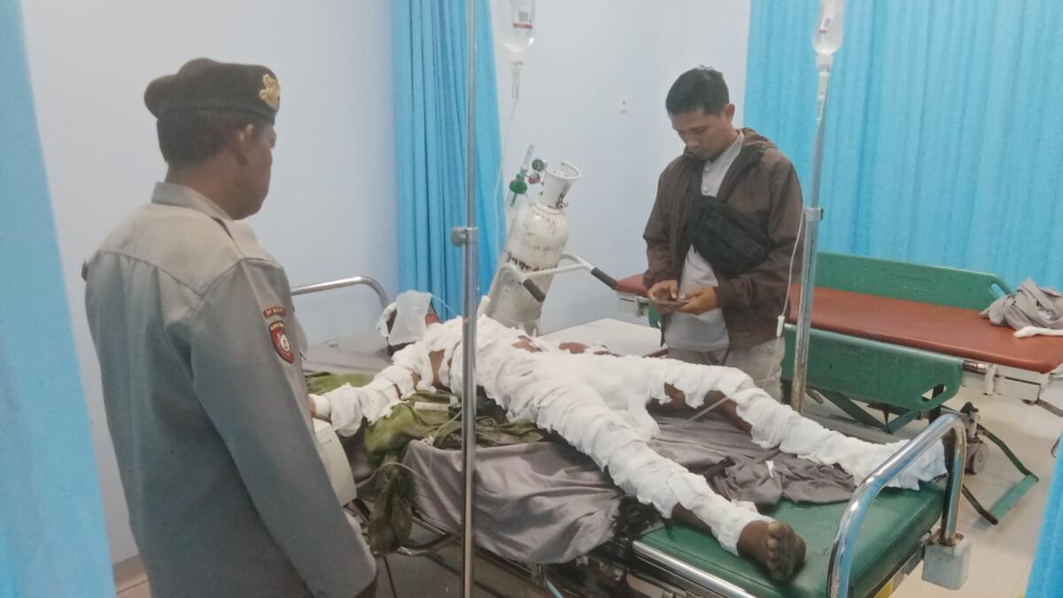 Kecelakaan di Poros Maros, Sopir Alami Luka Bakar